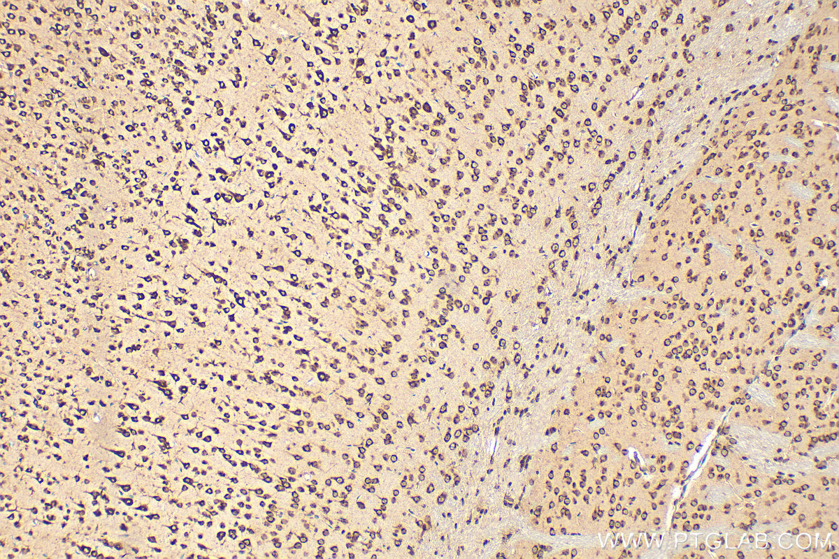 Immunohistochemistry (IHC) staining of mouse brain tissue using TMP21 Polyclonal antibody (15199-1-AP)