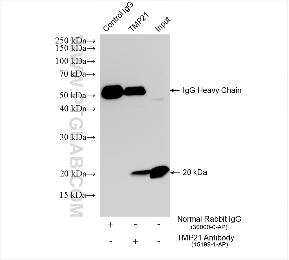 Immunoprecipitation (IP) experiment of BxPC-3 cells using TMP21 Polyclonal antibody (15199-1-AP)