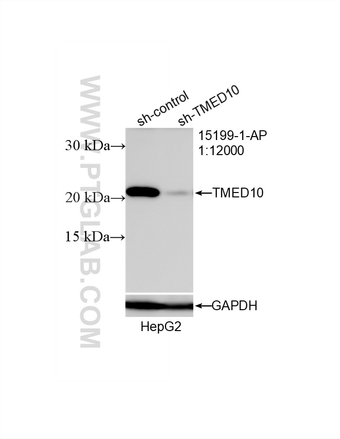 Western Blot (WB) analysis of HepG2 cells using TMP21 Polyclonal antibody (15199-1-AP)