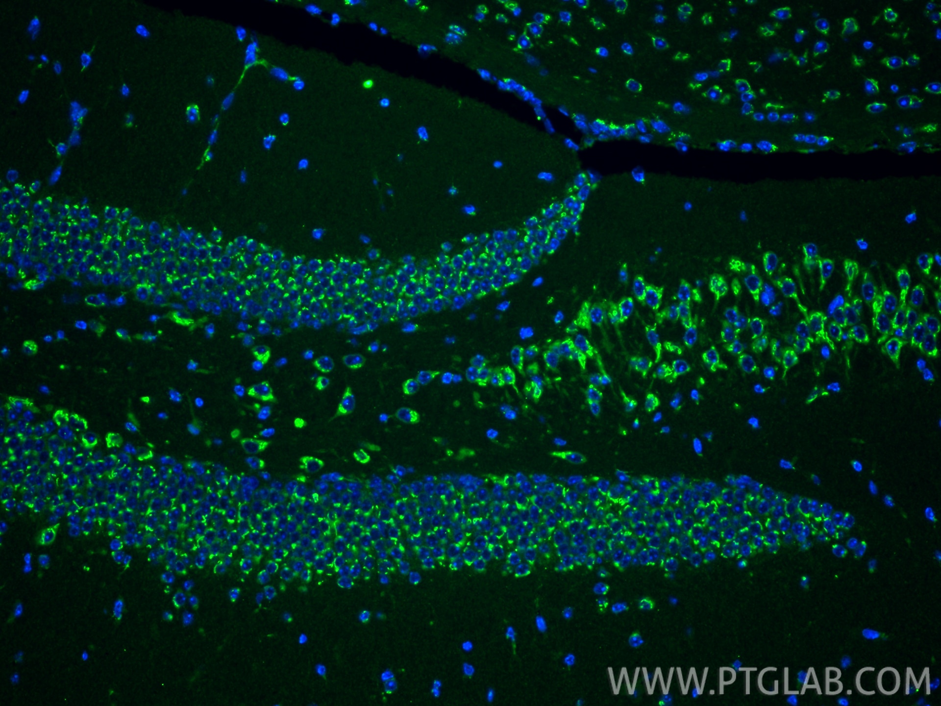 Immunofluorescence (IF) / fluorescent staining of mouse brain tissue using TMP21 Monoclonal antibody (67876-1-Ig)