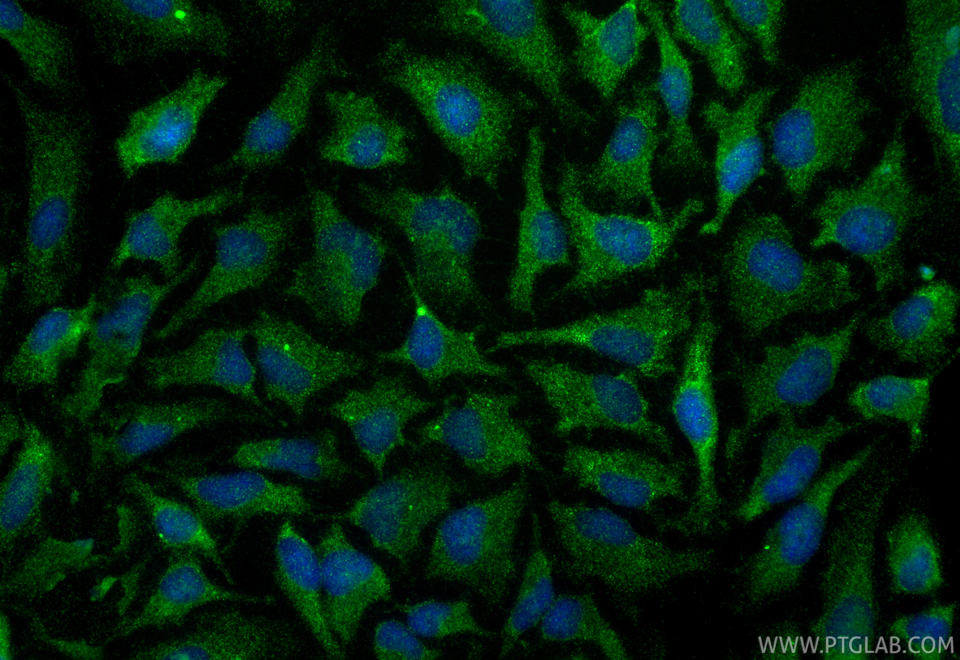 Immunofluorescence (IF) / fluorescent staining of HeLa cells using TMED2 Polyclonal antibody (11981-1-AP)