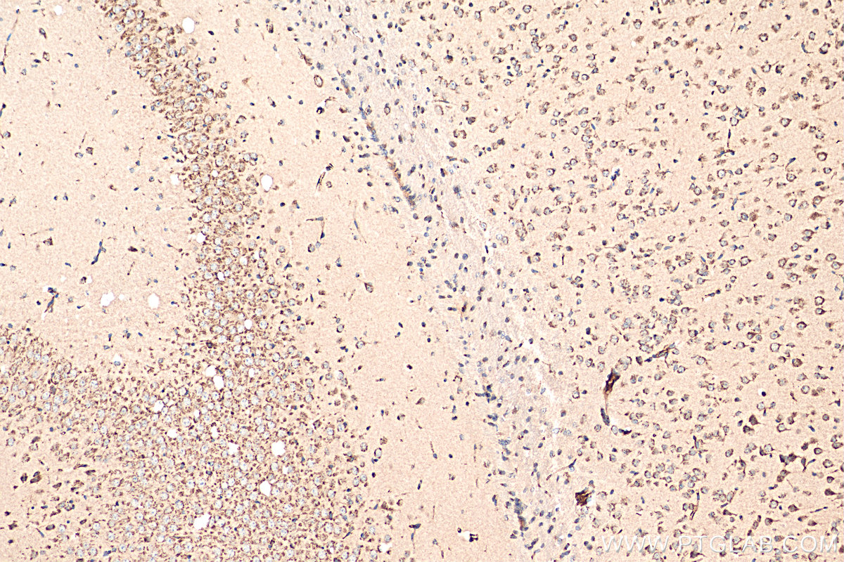 Immunohistochemistry (IHC) staining of mouse brain tissue using TMED2 Polyclonal antibody (11981-1-AP)
