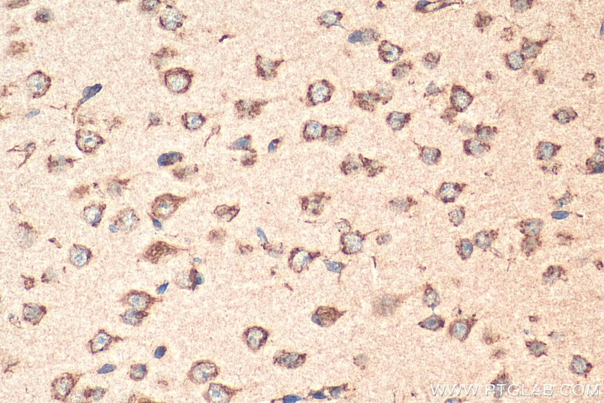 Immunohistochemistry (IHC) staining of mouse brain tissue using TMED2 Polyclonal antibody (11981-1-AP)