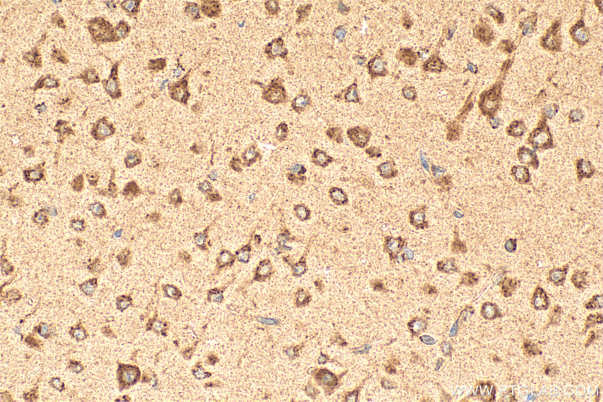 Immunohistochemistry (IHC) staining of mouse brain tissue using TMED2 Polyclonal antibody (11981-1-AP)