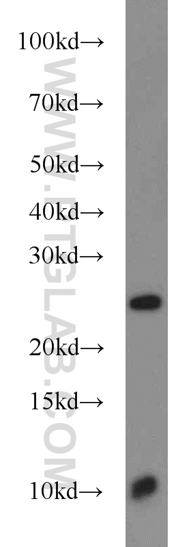 Western Blot (WB) analysis of MCF-7 cells using TMED3 Polyclonal antibody (21902-1-AP)