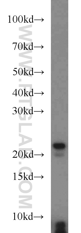 Western Blot (WB) analysis of mouse small intestine tissue using TMED3 Polyclonal antibody (21902-1-AP)