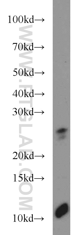 Western Blot (WB) analysis of mouse skin tissue using TMED3 Polyclonal antibody (21902-1-AP)