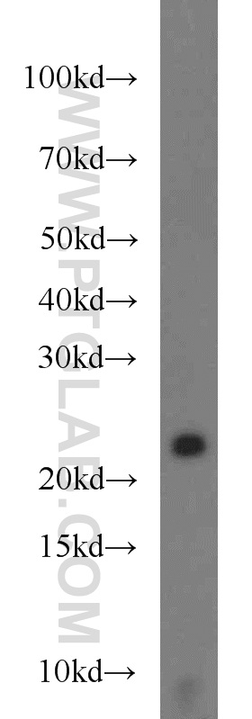 Western Blot (WB) analysis of HeLa cells using TMED3 Polyclonal antibody (21902-1-AP)