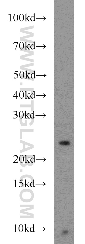 Western Blot (WB) analysis of HT-1080 cells using TMED3 Polyclonal antibody (21902-1-AP)