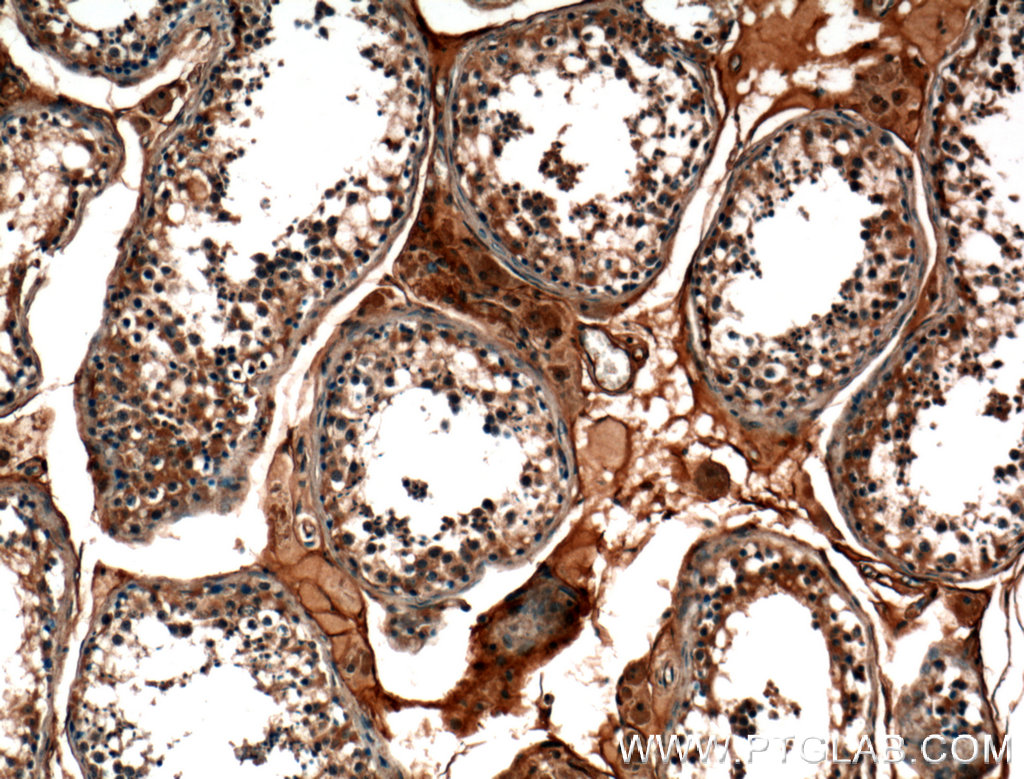 Immunohistochemistry (IHC) staining of human testis tissue using TMEM102 Polyclonal antibody (25505-1-AP)