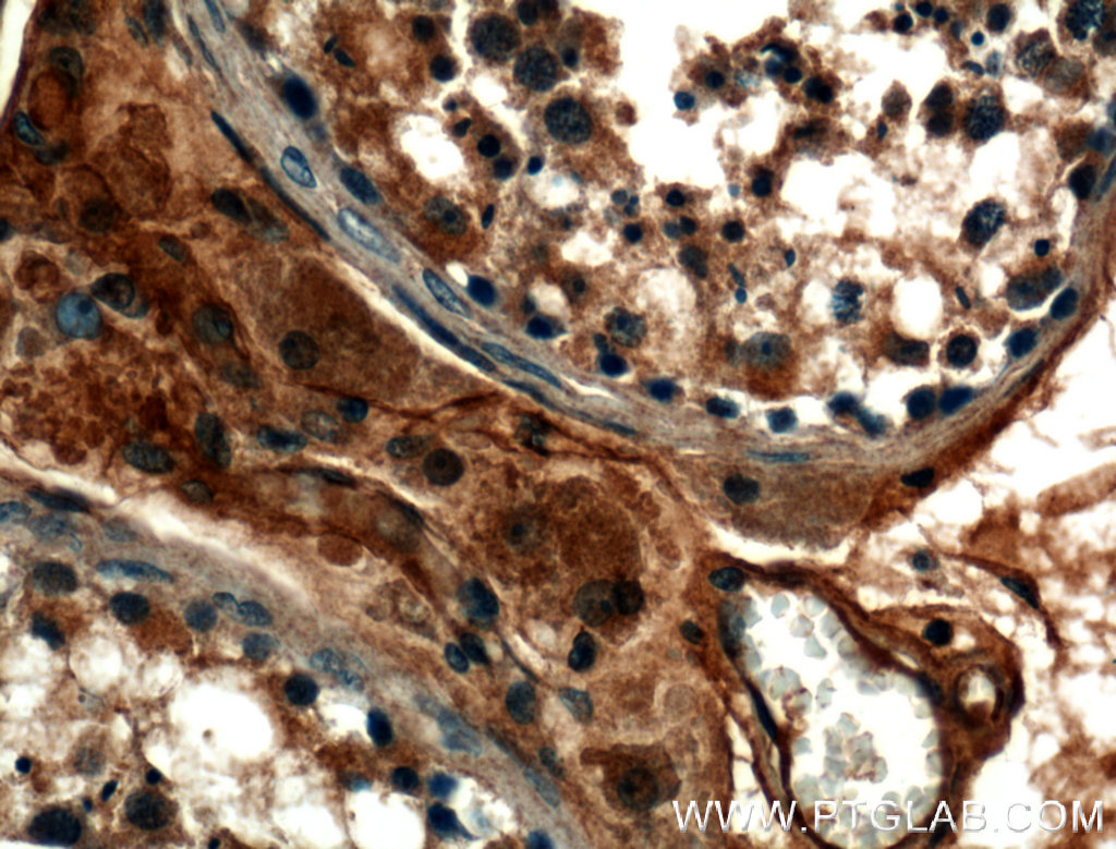 Immunohistochemistry (IHC) staining of human testis tissue using TMEM102 Polyclonal antibody (25505-1-AP)