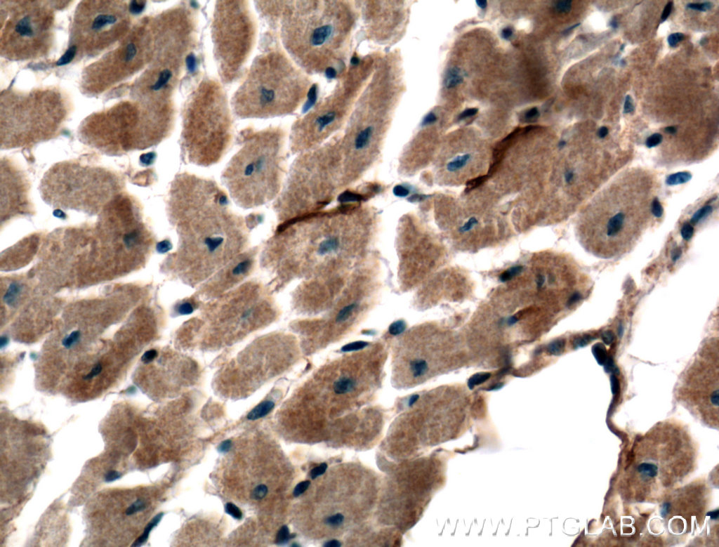 Immunohistochemistry (IHC) staining of human heart tissue using TMEM102 Polyclonal antibody (25505-1-AP)