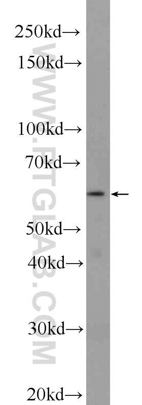 Western Blot (WB) analysis of HepG2 cells using TMEM102 Polyclonal antibody (25505-1-AP)