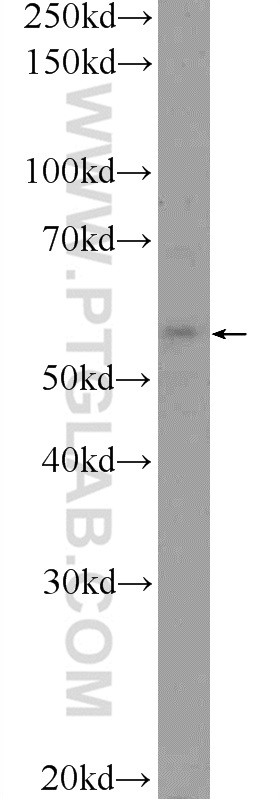 Western Blot (WB) analysis of HeLa cells using TMEM102 Polyclonal antibody (25505-1-AP)