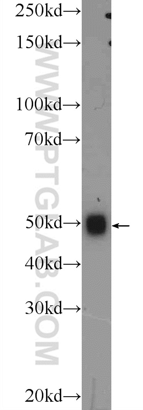 Western Blot (WB) analysis of mouse brain tissue using TMEM102 Polyclonal antibody (25505-1-AP)