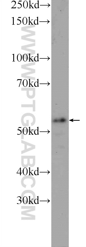 Western Blot (WB) analysis of Jurkat cells using TMEM102 Polyclonal antibody (25505-1-AP)