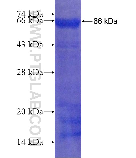 TMEM102 fusion protein Ag22213 SDS-PAGE