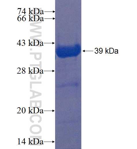 TMEM102 fusion protein Ag22398 SDS-PAGE