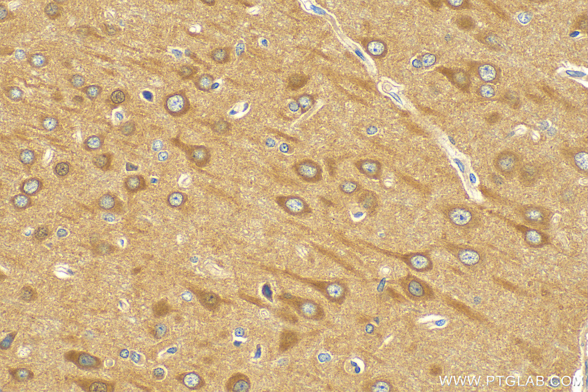 Immunohistochemistry (IHC) staining of rat brain tissue using TMEM106B (150-274aa) Polyclonal antibody (20995-1-AP)