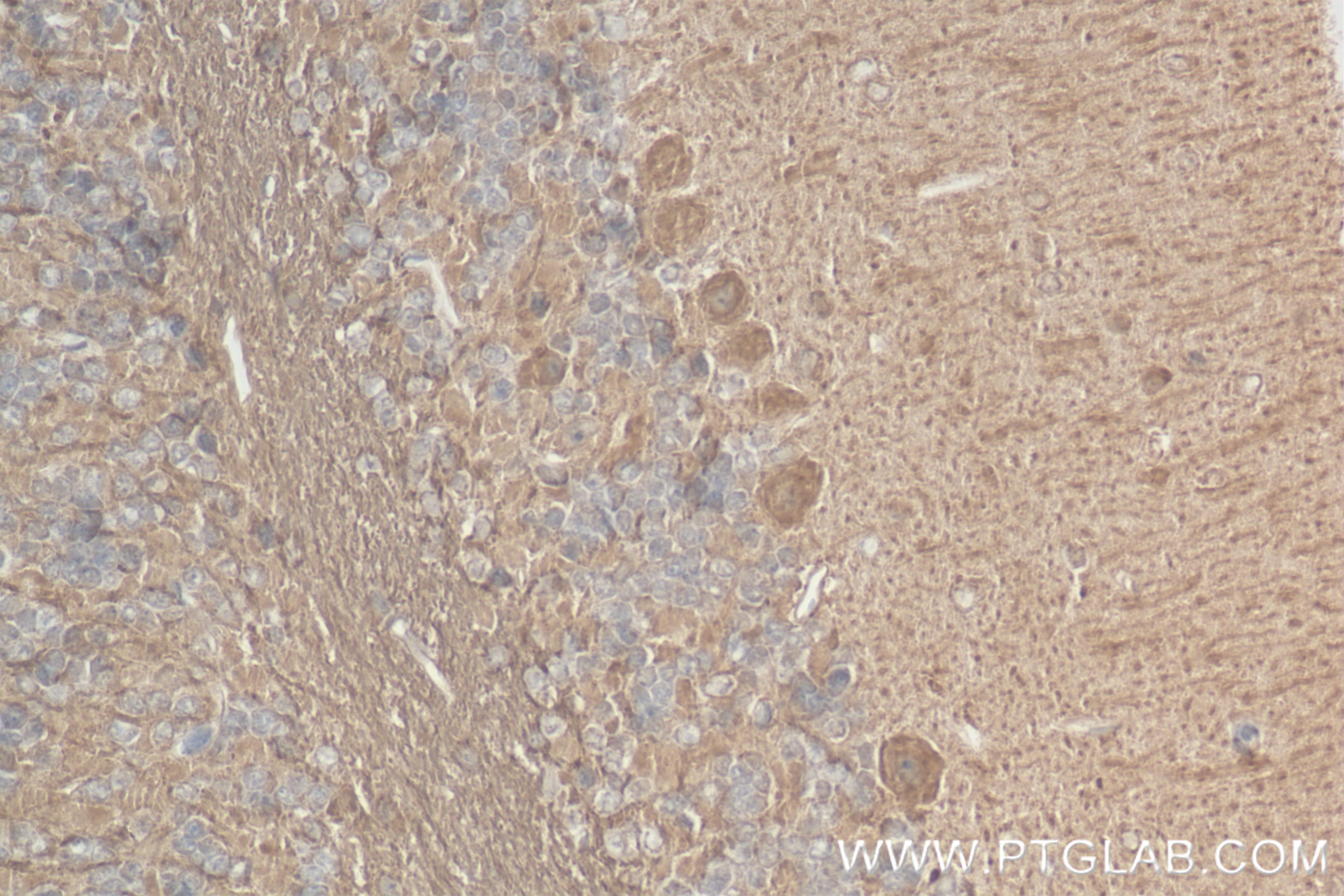 Immunohistochemistry (IHC) staining of mouse cerebellum tissue using TMEM106B Recombinant antibody (84196-2-RR)