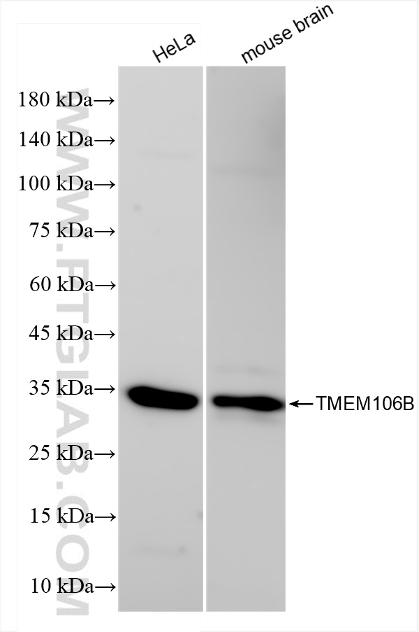 TMEM106B