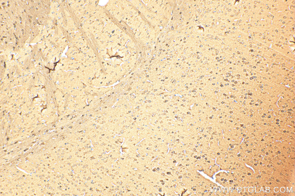 Immunohistochemistry (IHC) staining of mouse brain tissue using Retrolinkin Polyclonal antibody (15177-1-AP)