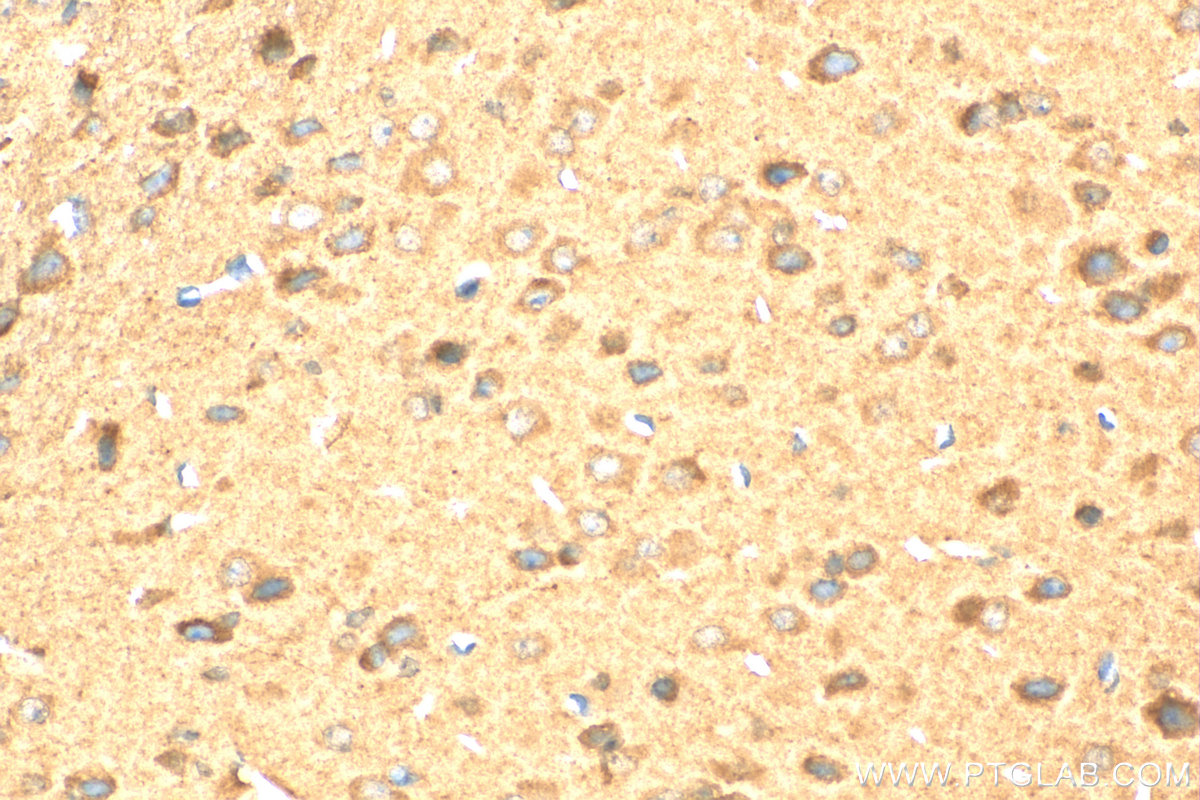 Immunohistochemistry (IHC) staining of mouse brain tissue using Retrolinkin Polyclonal antibody (15177-1-AP)