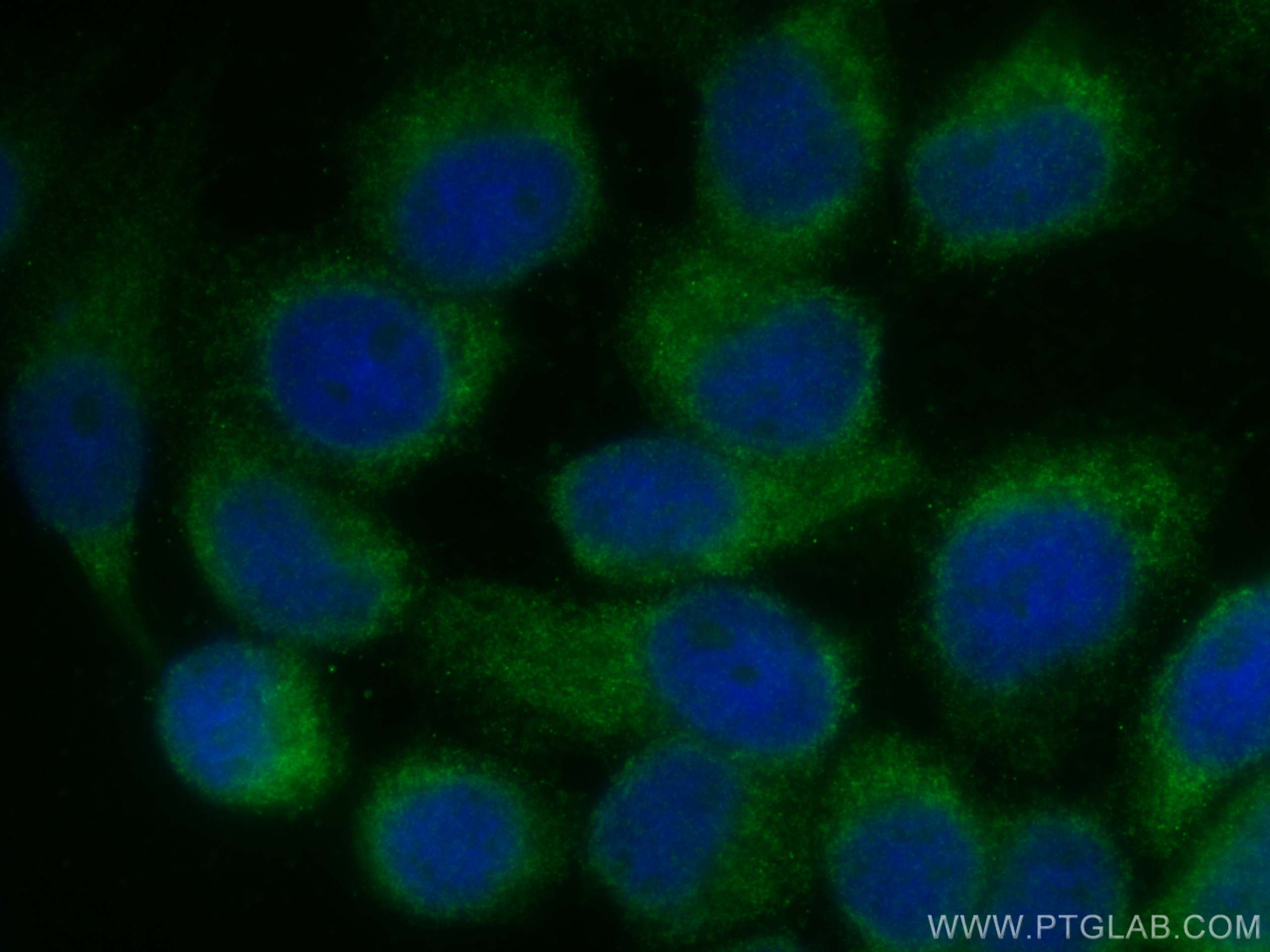 Immunofluorescence (IF) / fluorescent staining of A431 cells using TMEM111 Polyclonal antibody (24645-1-AP)