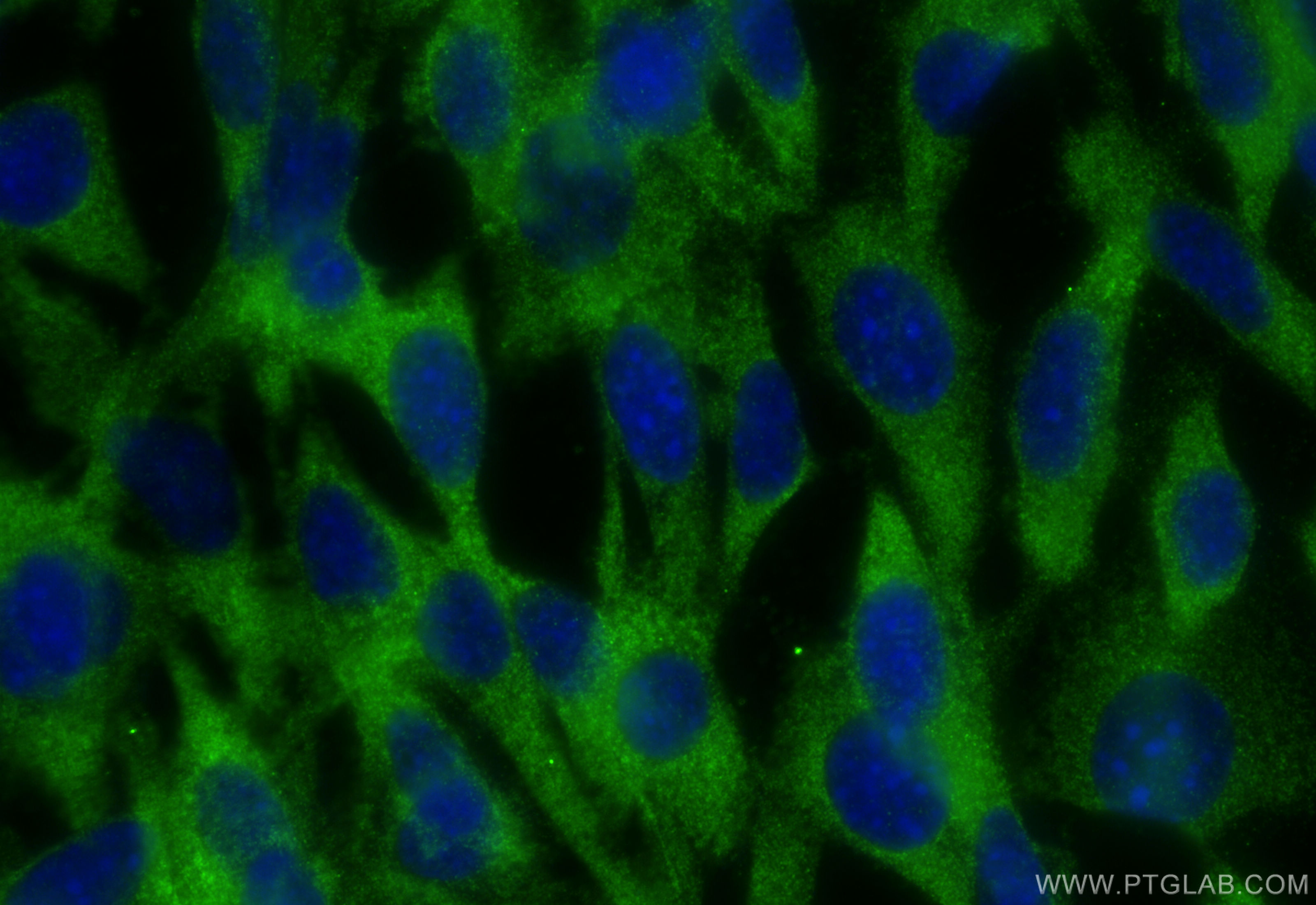 Immunofluorescence (IF) / fluorescent staining of NIH/3T3 cells using TMEM127 Polyclonal antibody (23142-1-AP)