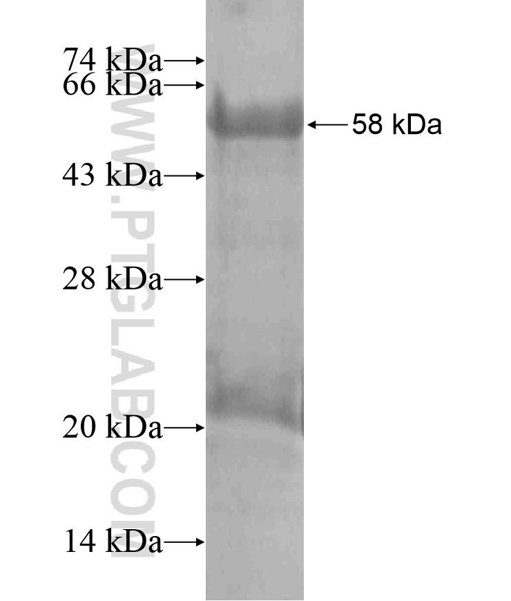 TMEM132A fusion protein Ag18142 SDS-PAGE