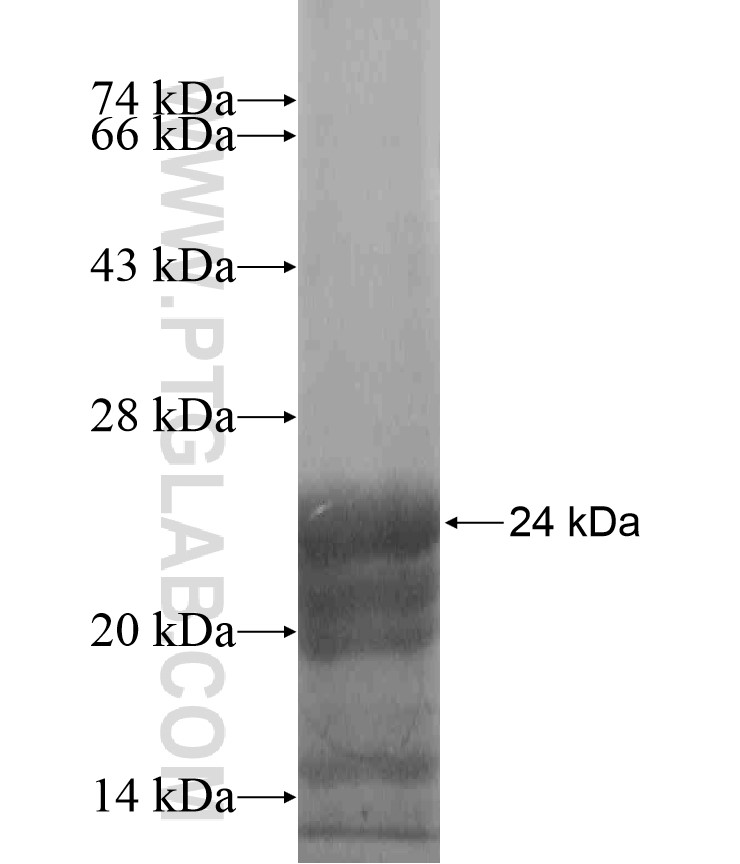 TMEM132D fusion protein Ag18152 SDS-PAGE