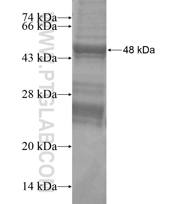 TMEM132D fusion protein Ag18405 SDS-PAGE