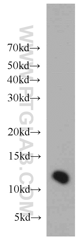 Western Blot (WB) analysis of HeLa cells using TMEM141 Polyclonal antibody (16092-1-AP)