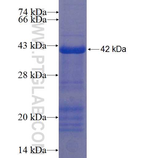 TMEM149 fusion protein Ag22617 SDS-PAGE