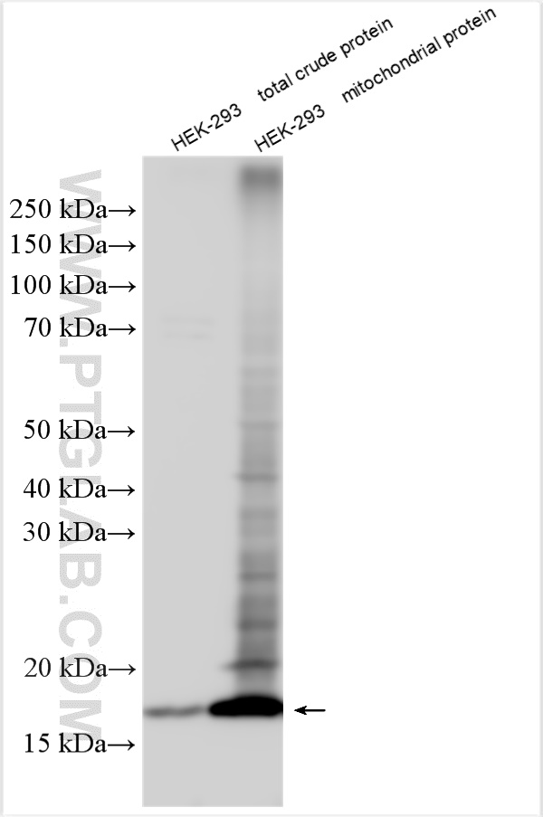 Western Blot (WB) analysis of various lysates using TMEM160 Polyclonal antibody (26451-1-AP)