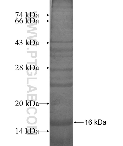 TMEM161A fusion protein Ag18974 SDS-PAGE