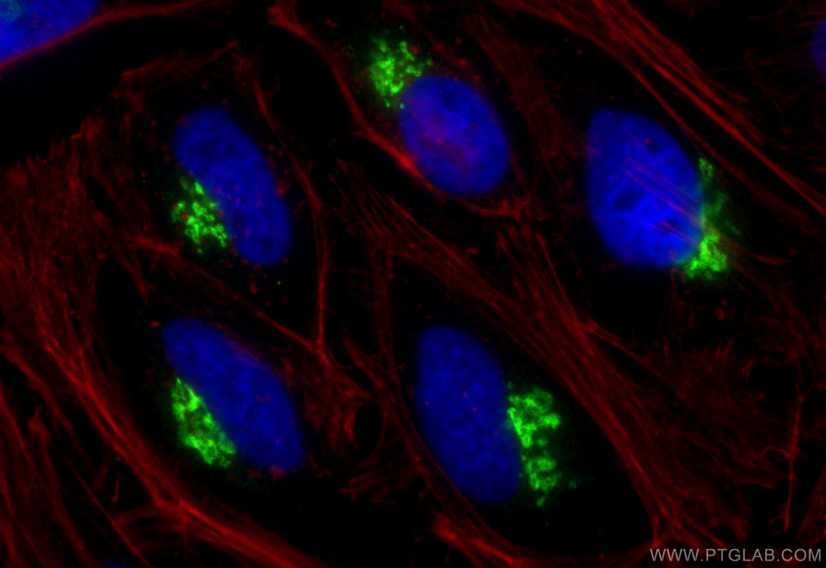 Immunofluorescence (IF) / fluorescent staining of HeLa cells using TMEM165 Polyclonal antibody (20485-1-AP)