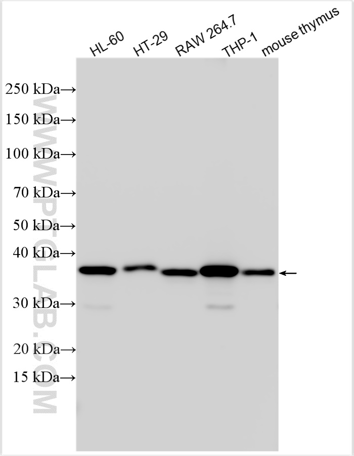 Western Blot (WB) analysis of various lysates using TMEM173/STING Polyclonal antibody (19851-1-AP)