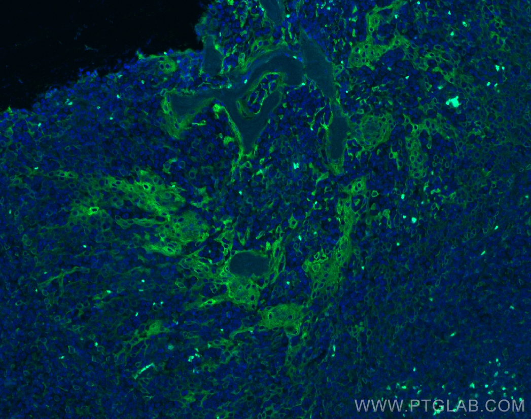 Immunofluorescence (IF) / fluorescent staining of human tonsillitis tissue using TMEM173/STING Monoclonal antibody (66680-1-Ig)