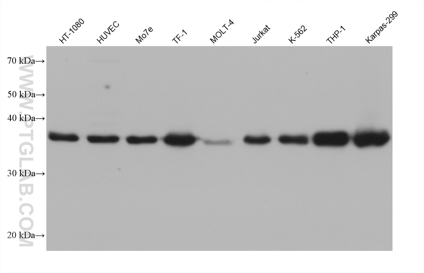Western Blot (WB) analysis of various lysates using TMEM173/STING Monoclonal antibody (66680-1-Ig)