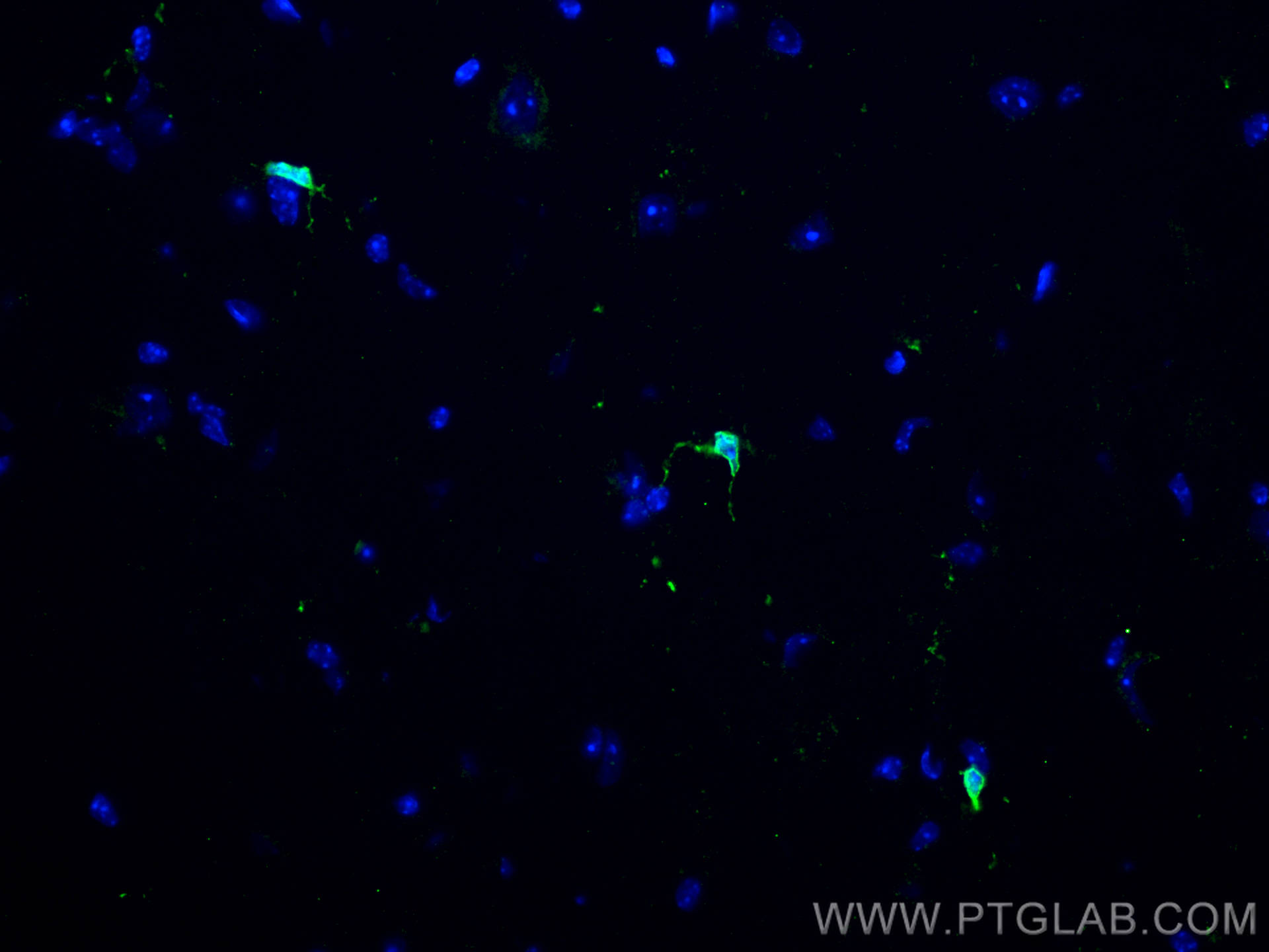 Immunofluorescence (IF) / fluorescent staining of mouse cerebellum tissue using TMEM173/STING Recombinant antibody (80165-1-RR)