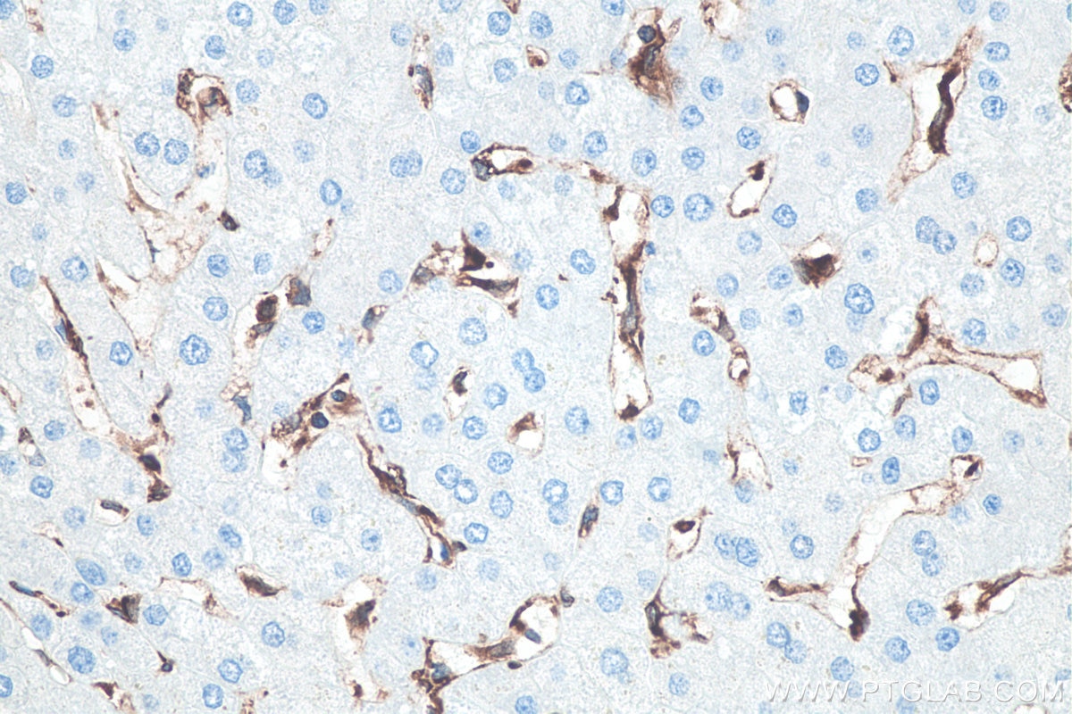 Immunohistochemistry (IHC) staining of human liver tissue using TMEM173/STING Recombinant monoclonal antibody (80165-1-RR)