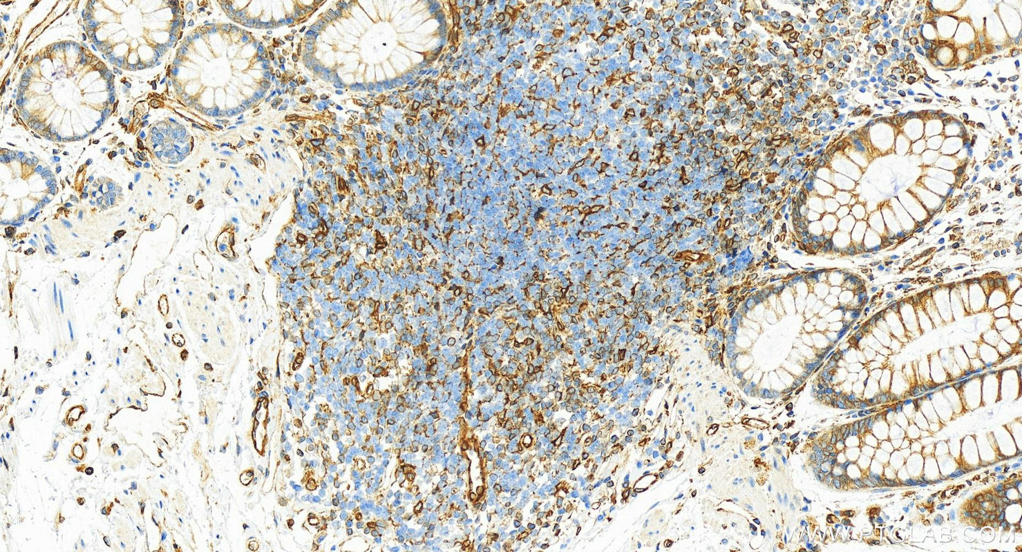 Immunohistochemistry (IHC) staining of human colon tissue using TMEM173/STING Recombinant antibody (80165-1-RR)