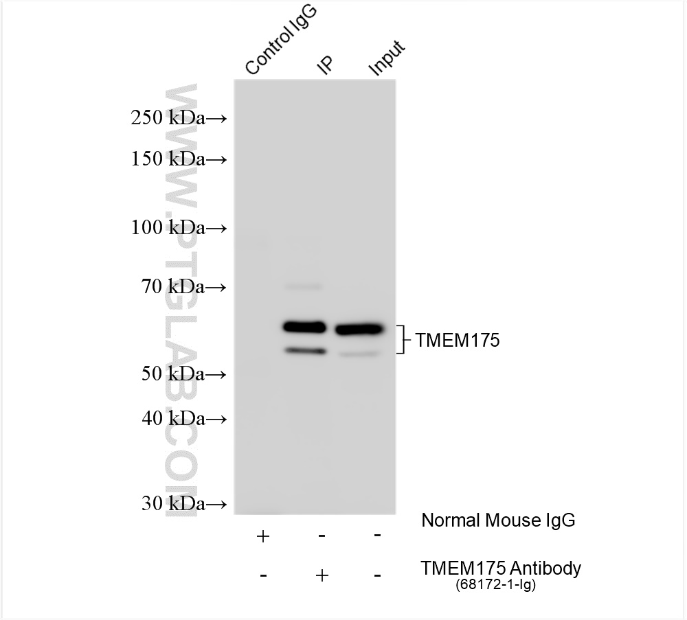 Immunoprecipitation (IP) experiment of mouse brain tissue using TMEM175 Monoclonal antibody (68172-1-Ig)