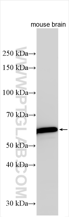 Western Blot (WB) analysis of various lysates using TMEM175 Monoclonal antibody (68172-1-Ig)