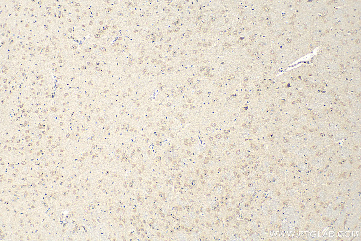 Immunohistochemistry (IHC) staining of mouse brain tissue using TMEM184B Polyclonal antibody (28031-1-AP)