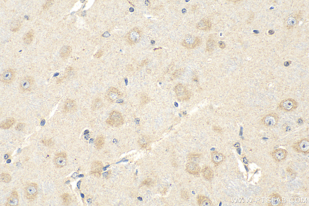 Immunohistochemistry (IHC) staining of mouse brain tissue using TMEM184B Polyclonal antibody (28031-1-AP)