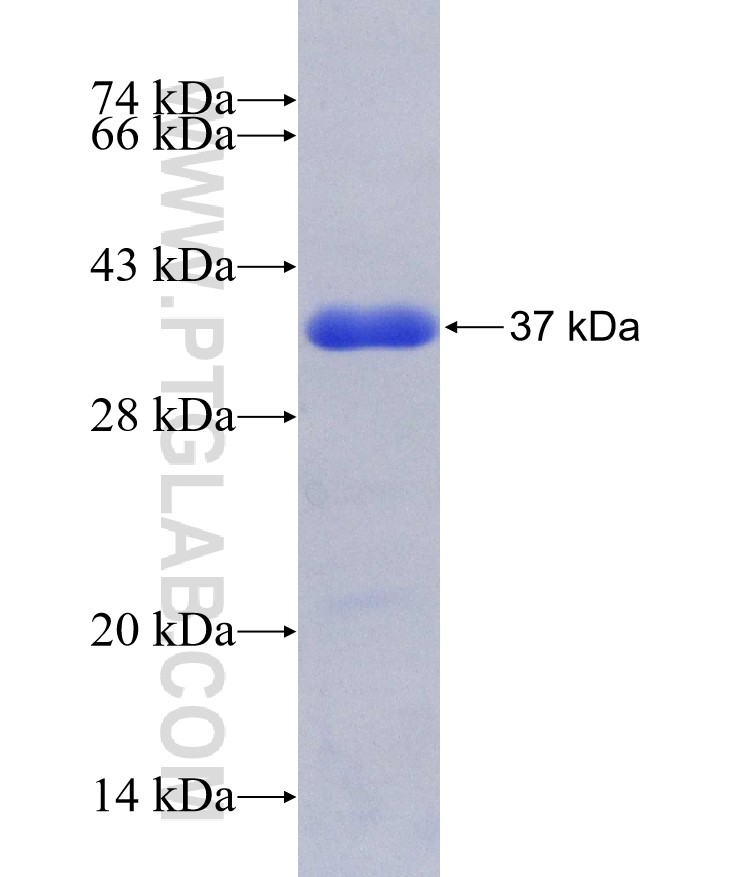 TMEM200C fusion protein Ag29577 SDS-PAGE