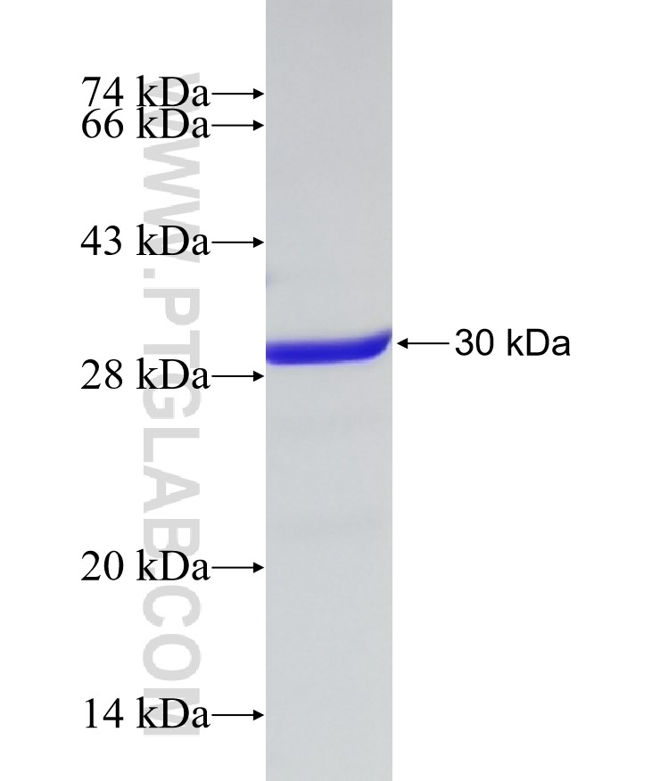 TMEM206 fusion protein Ag15164 SDS-PAGE