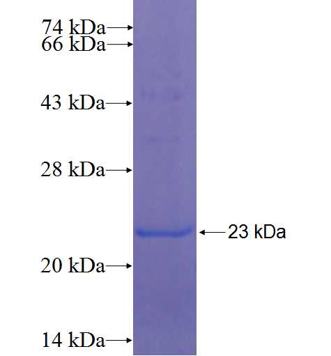 TMEM222 fusion protein Ag22384 SDS-PAGE